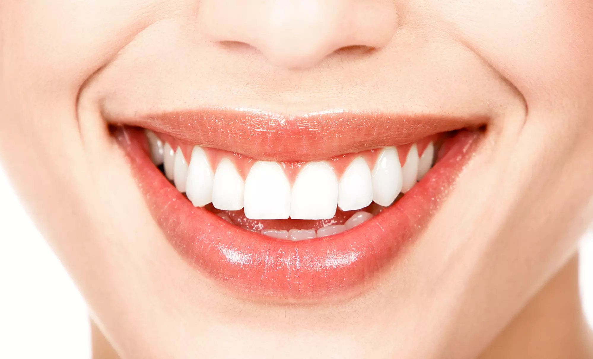 Strahlendes Lächeln mit 30, 60 oder 90 Min. kosmetischem Zahn-Bleaching bei Rose Beautylounge (bis 37% sparen) - Primary Image