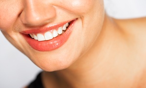 London Smile Care: Scale and Polish with an X-Ray and Examination, with Option to Upgrade to Airflow Polish at London Smile Care