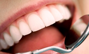 JORGE MATO DENTAL 2: Limpieza bucal con ultrasonidos, revisión, pulido, fluorización y blanqueamiento LED desde 12,90 € en Jorge Mato Dental
