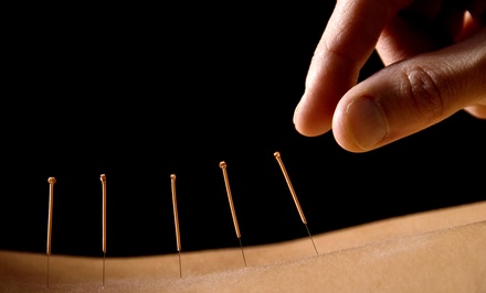 One initial consultation and acupuncture treatment - Trio Chiropractic and Wellness Center