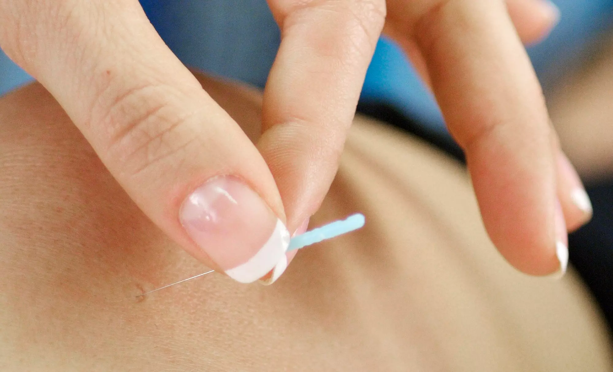 Discover Restructured Health Services with diverse 60-minute acupuncture and massage sessions, all with up to 50% off. - Primary Image