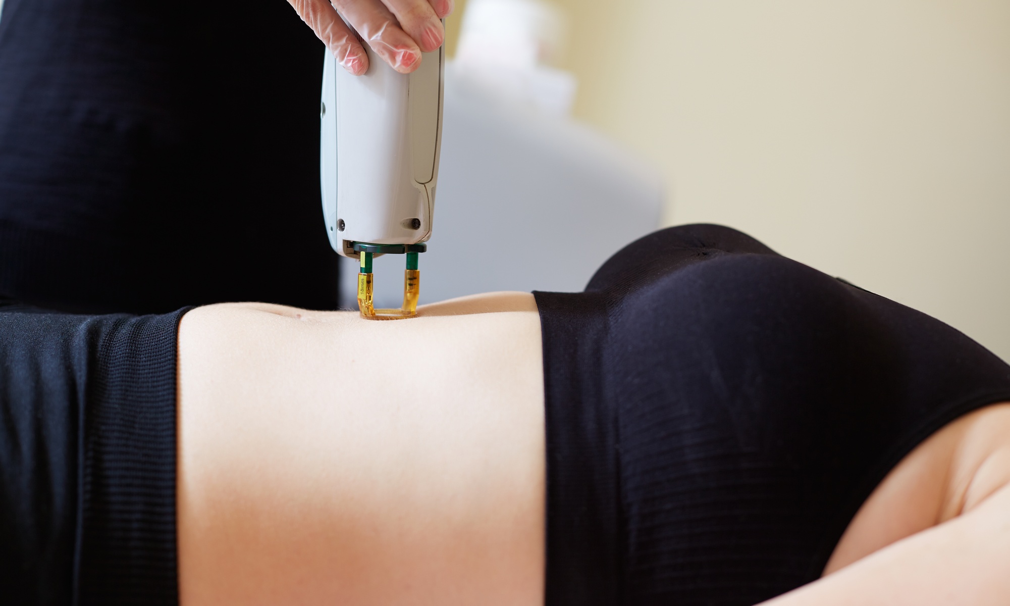 Relieve Pain with MLS Laser Therapy Sessions