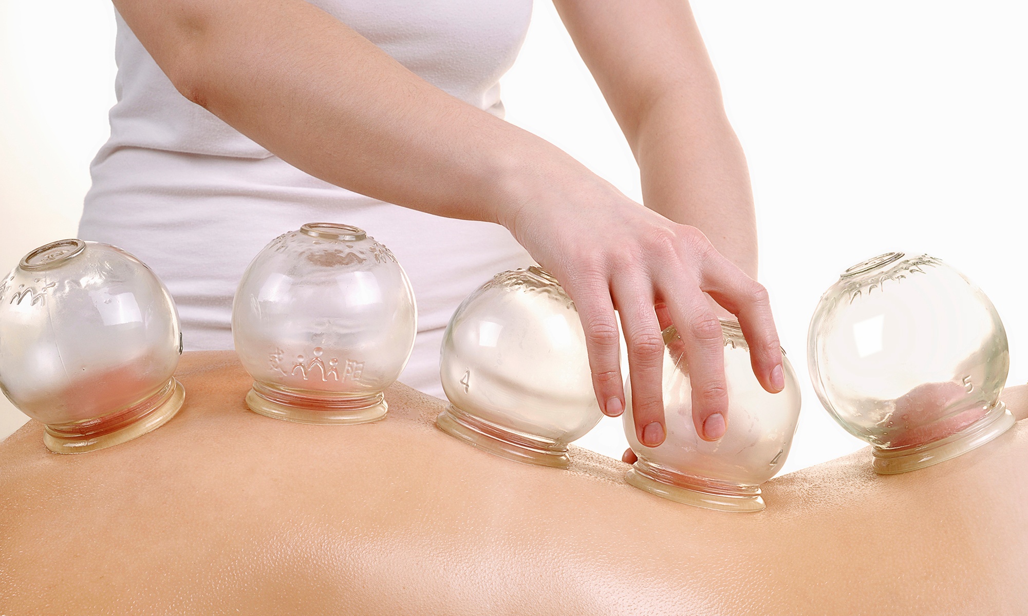 Cupping, Tui Na Massage & Acupuncture Healing Sessions 