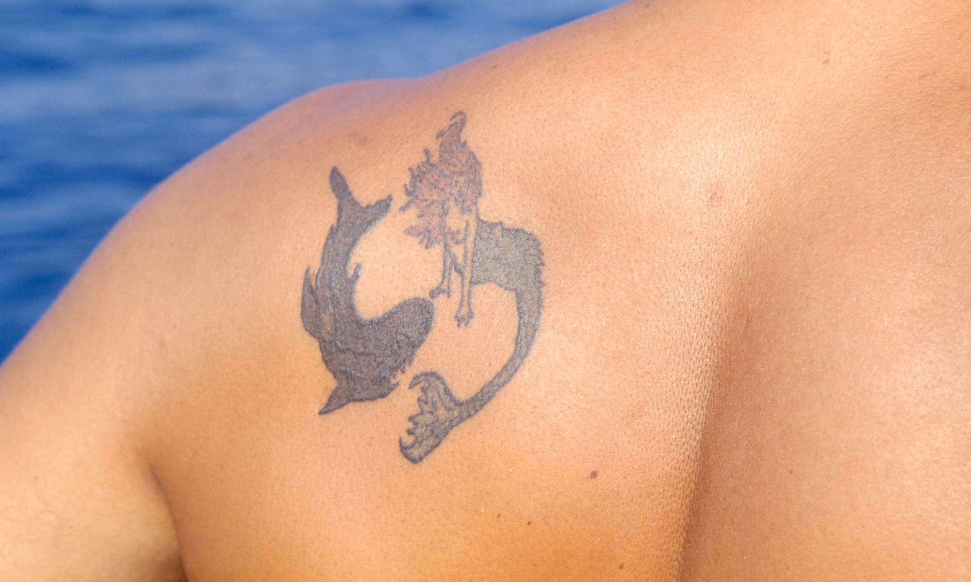 3 Pico Laser Tattoo Removal Sessions on an Area Up to 0.5 to 5 Inch