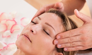 Garden Green Therapy Center: Up to Three Sessions of Acupuncture or Up to 75-Minute Sports or Deep Tissue Therapy at Garden Green Therapy Center