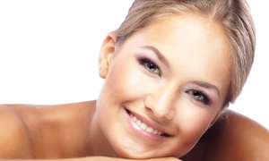 STETIC & PELUQUERÍA KIMBERLY: 3 o 5 sesiones de tratamiento facial con microdermoabrasión y radiofrecuencia desde 49 €