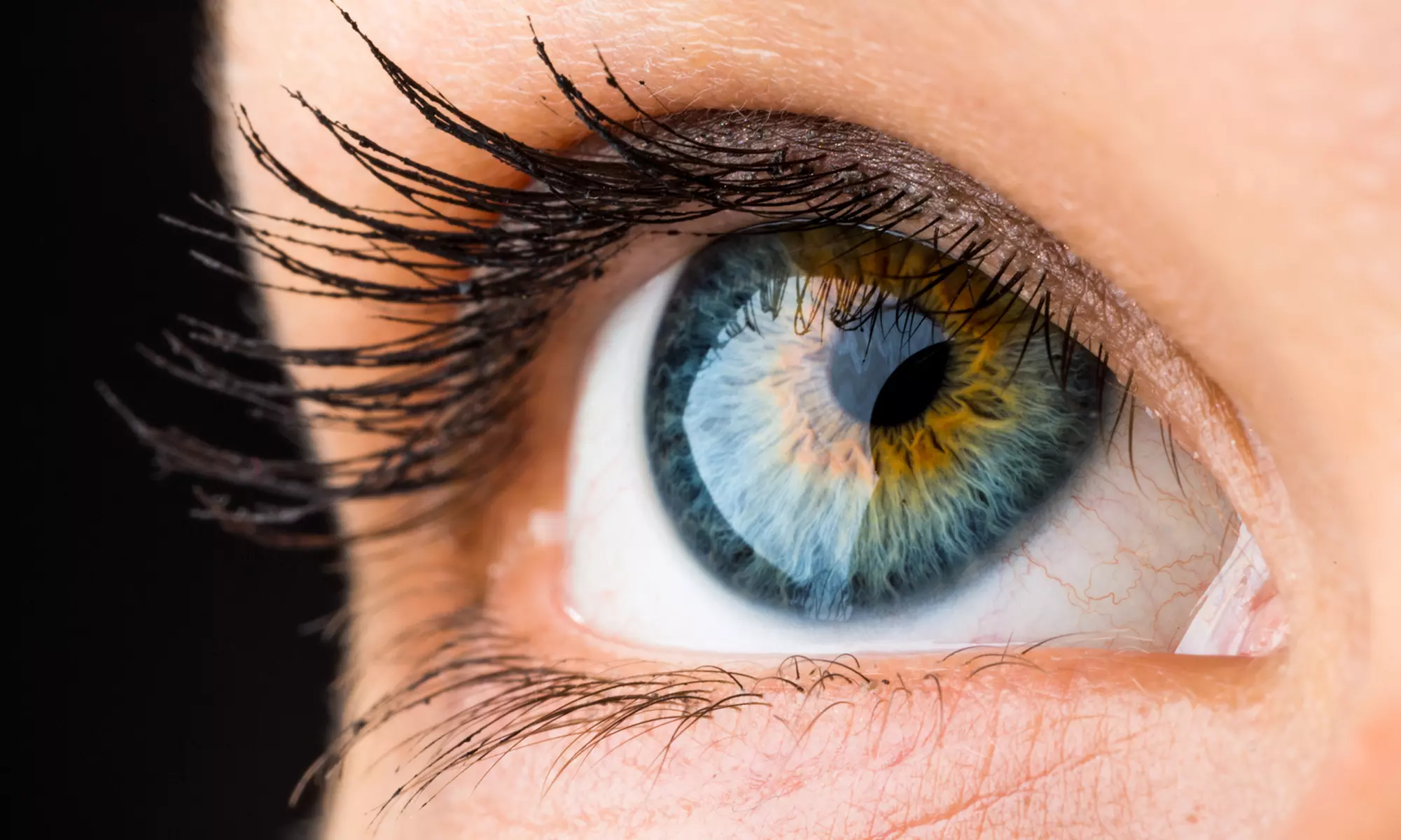 Up to 53% Off on LASIK Surgery at Clear Vue Eye Center - Primary Image