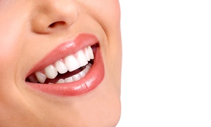 DENTAESTHETIC CORPORATION: Brackets internos con estudio, limpieza y 6 revisiones desde 399 €