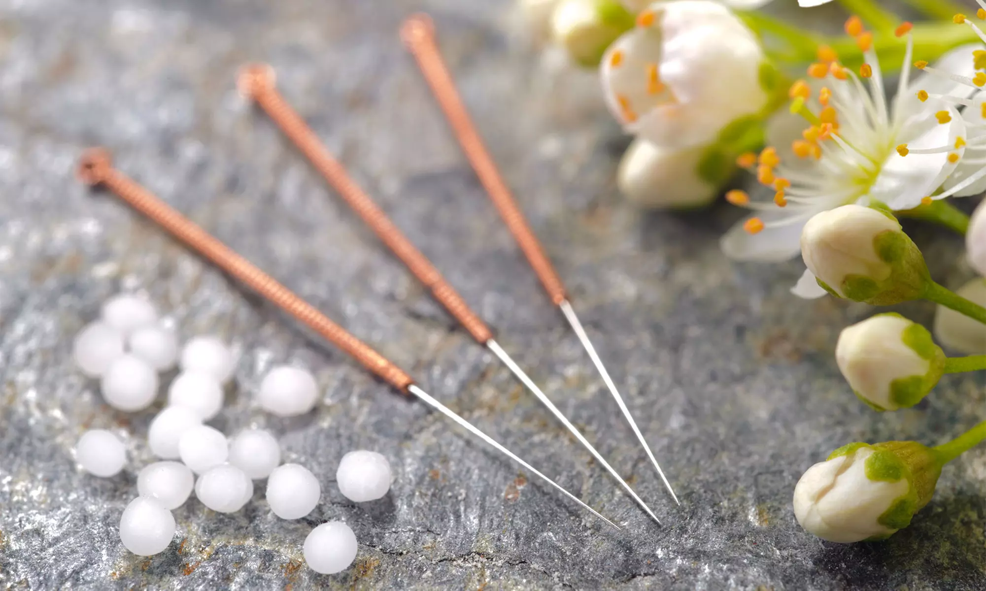 Up to 55% Off on Acupuncture at Golden Touch Acupuncture - Primary Image