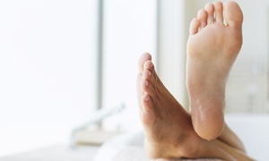BARE Laser: One or Four Laser Fungus-Removal Treatments for Up to 5 or 10 Toenails at BARELaser (Up to 72% Off)