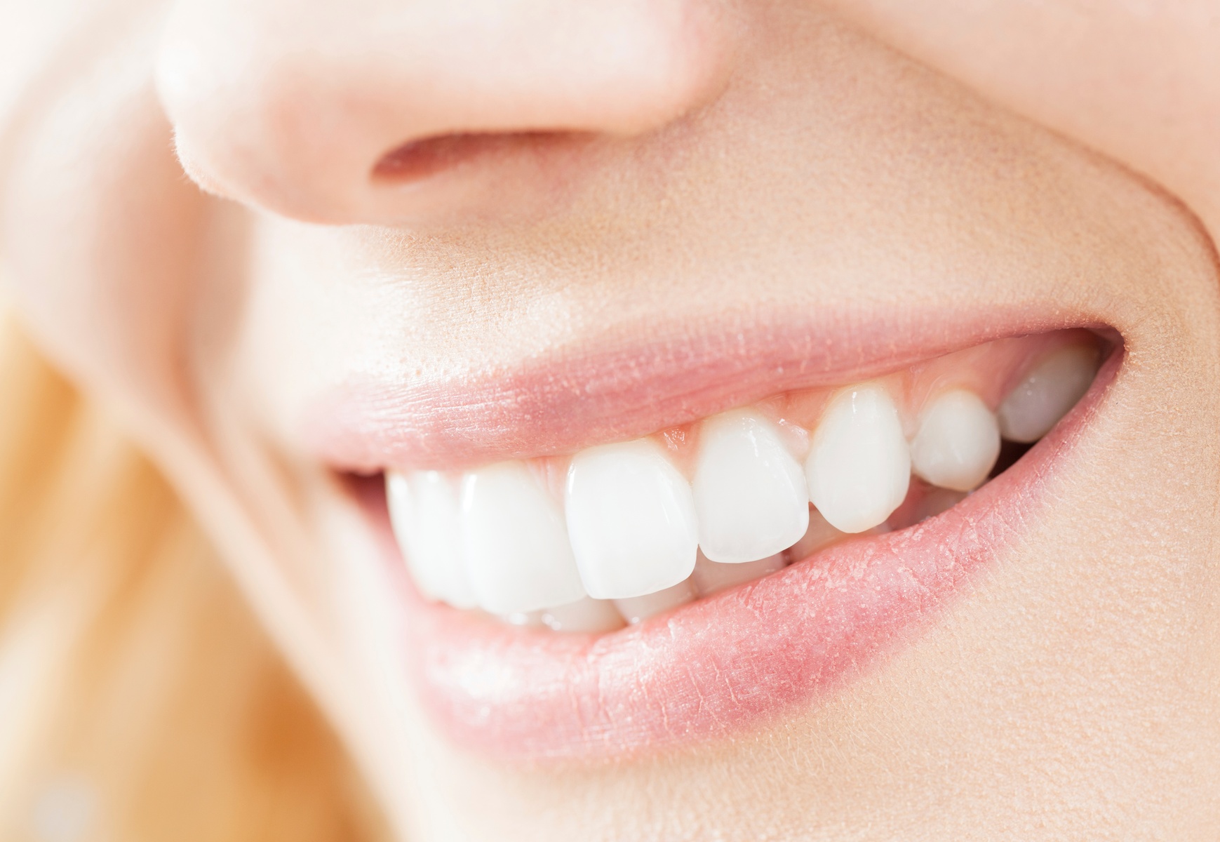Achieve a Brighter Smile with Teeth Whitening at Sculpted By Bella, One Session with up to 52% Off - Primary Image