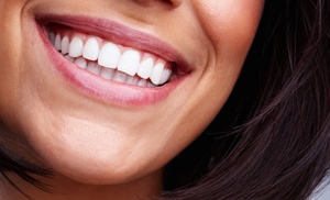 Up to 72% Off on Teeth Cleaning at Crescent Family Dental