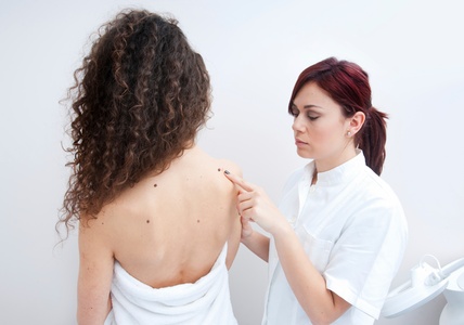 Removal of Up to 5 Skin Tags, Cherry Angiomas, Moles or Milia for 2mm size - Lasting Lines