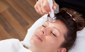 Up to 54% Off on Microdermabrasion at Seu Momento