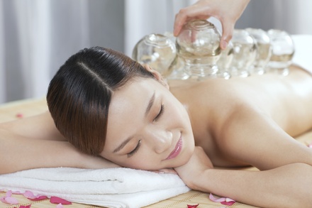 Cupping Session - Present Acupuncture