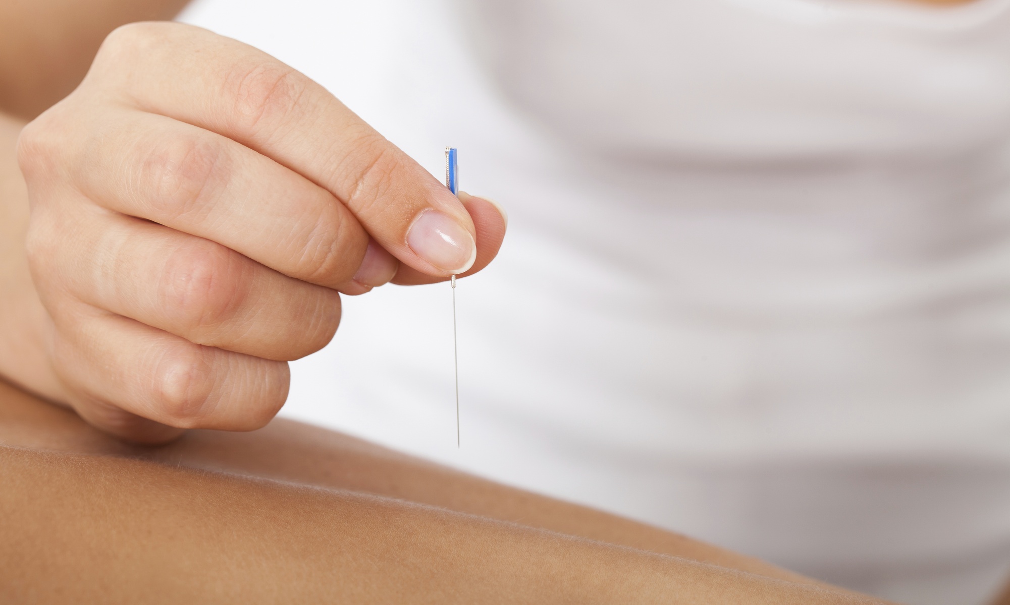 Up to 50% Off on Acupuncture at Zen Holistic Health - Primary Image