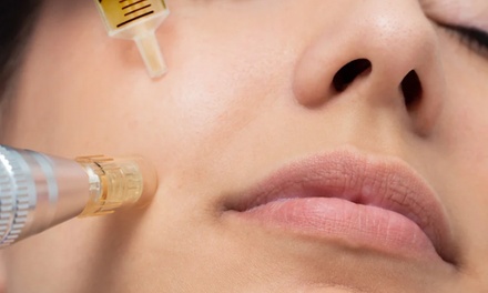 One Microneedling Treatment - Browvation