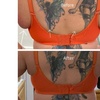 Image 2: Fat Dissolving: Target Medium/Large Areas with Optional Anti-Cellulite