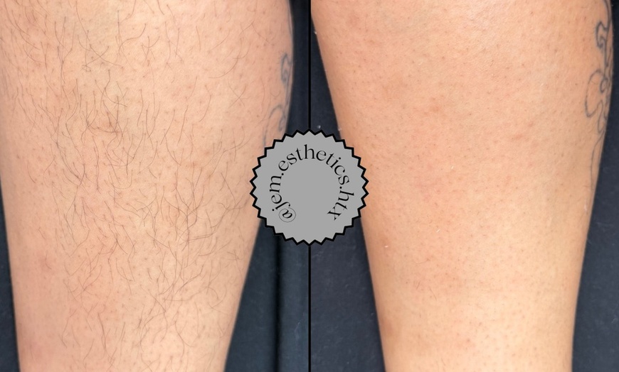 Image 2: Smooth Skin with Both Legs, Underarm, Full Face, or Bikini Wax Service