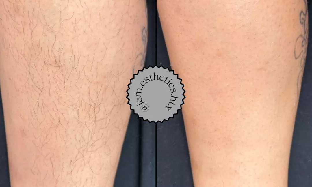 Smooth Skin with Both Legs, Underarm, Full Face, or Bikini Wax Service