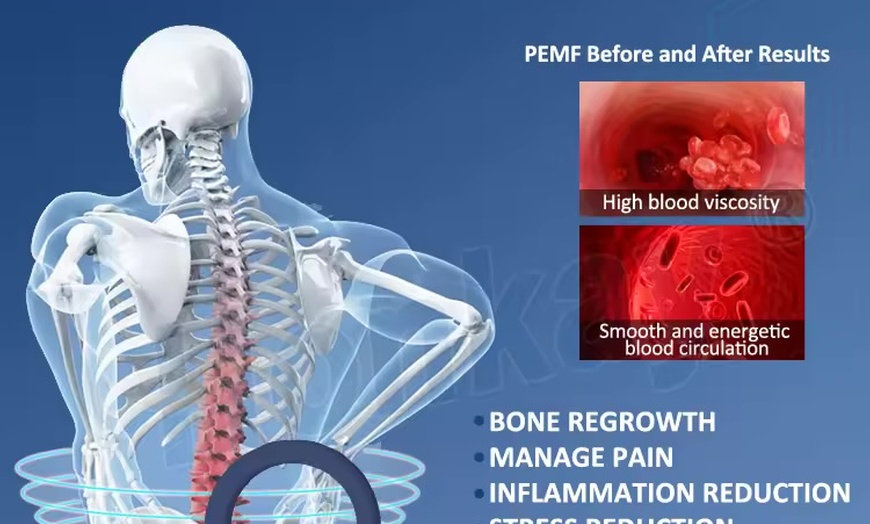 Image 5: Advanced PEMF Therapy for Total Body Renewal