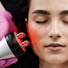 Image 1: Glow with 2 or 4 Thermal Rejuvenation Skin-Tightening Facial Lift