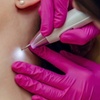 Image 1: Experience Le Lux Beautique's non-invasive skin tag, spot removal options with up to 75% discount