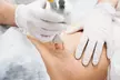Up to 50% Off on Facial - Thermal Rejuvenation at UK Aesthetics Lounge - Image 5