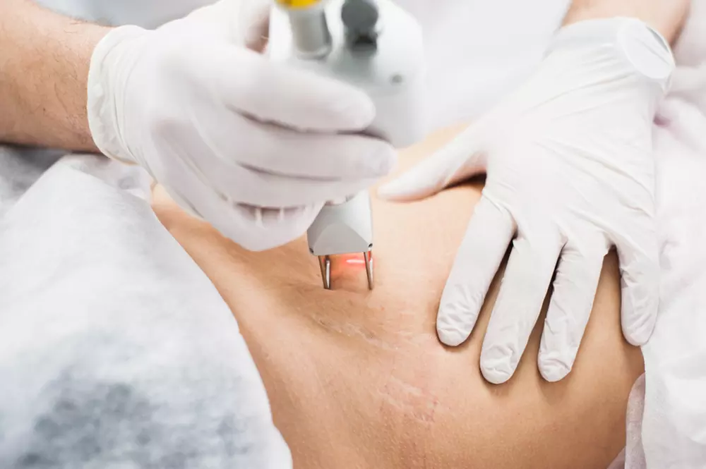 Up to 50% Off on Facial - Thermal Rejuvenation at UK Aesthetics Lounge