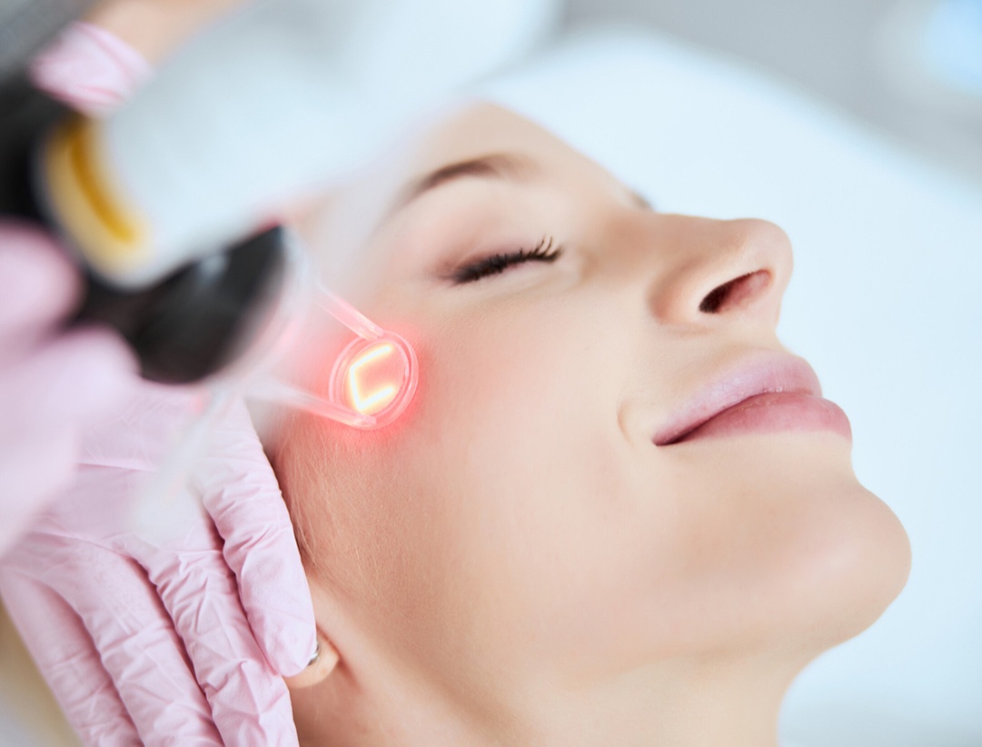 Up to 45% Off on Laser Skin Resurfacing at Radiance Permanent Makeup