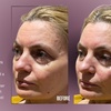 Image 6: Up to 38% Off on Injection - Dermal Filler at Divine Aesthetics Clinic London