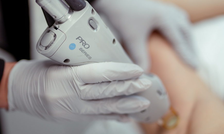 Image 2: Up to 73% Off on Laser Hair Removal at Hollywood Laser Med Spa