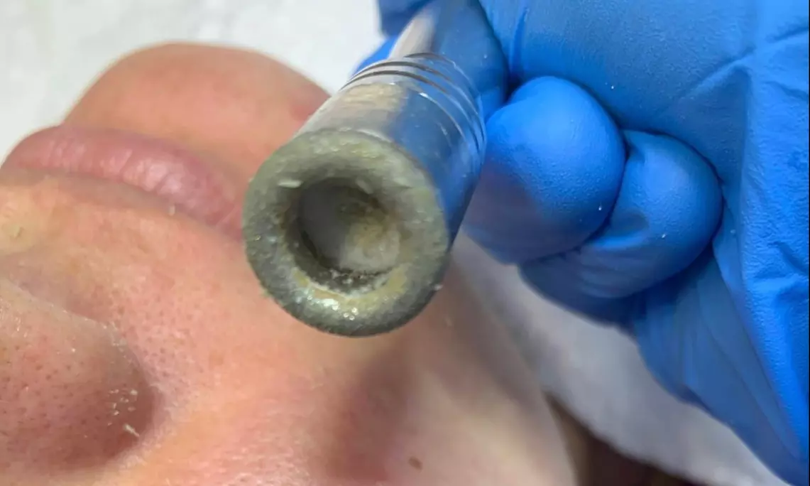 Up to 44% Off on Moisturizing Facial at En Privé