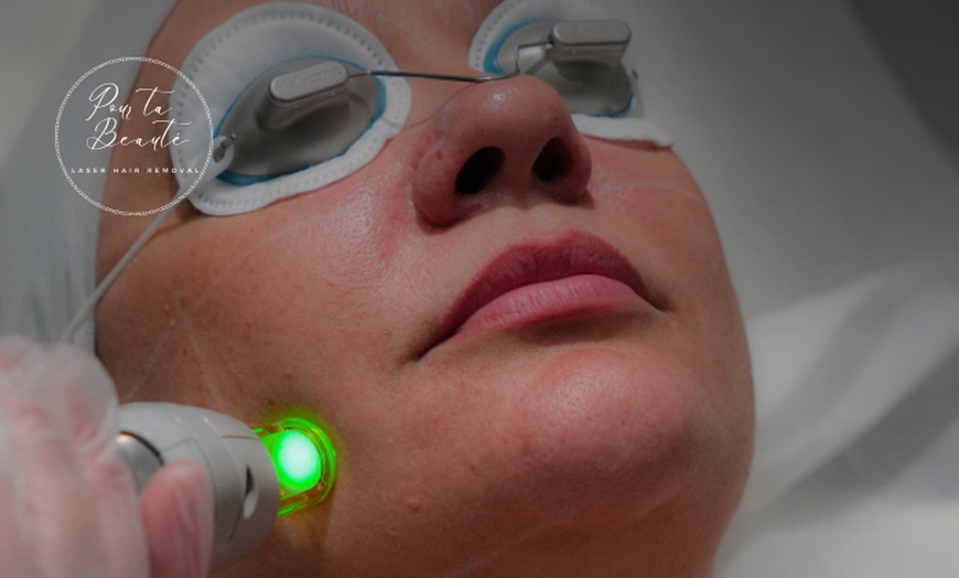 Image 6: Candela GentleMax Pro Laser Hair Removal at Pour Ta Beauté Laser Spa