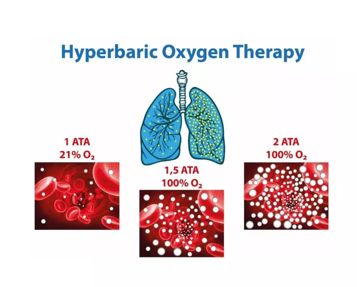 Up to 44% Off on Oxygen Bar at River Wellness Lab