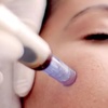 Image 1: Rejuvenate Mom’s Glow: Up to 75% at The Laser Lab