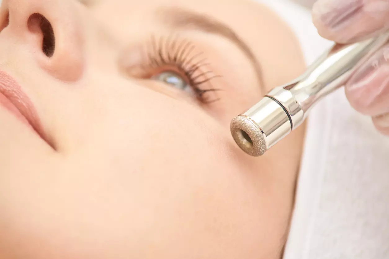 Up to 45% Off on Microdermabrasion at The Sculpting Art - Primary Image