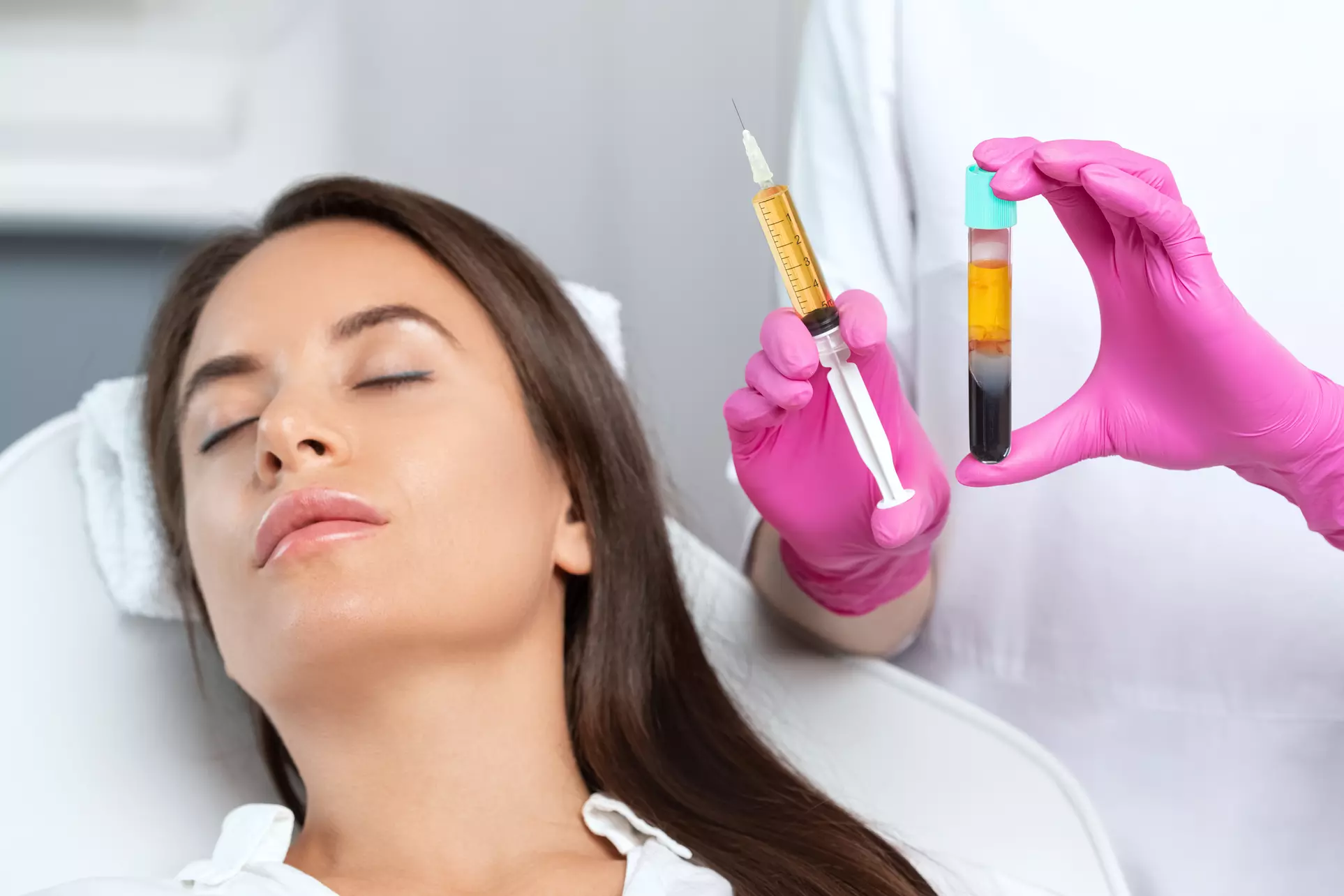 Up to 43% Off on Micro-Needling at Xhale Med Spa - Primary Image