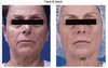 Up to 60% Off on Radio Frequency Skin Tightening at Sculpting Beauty by Pam
