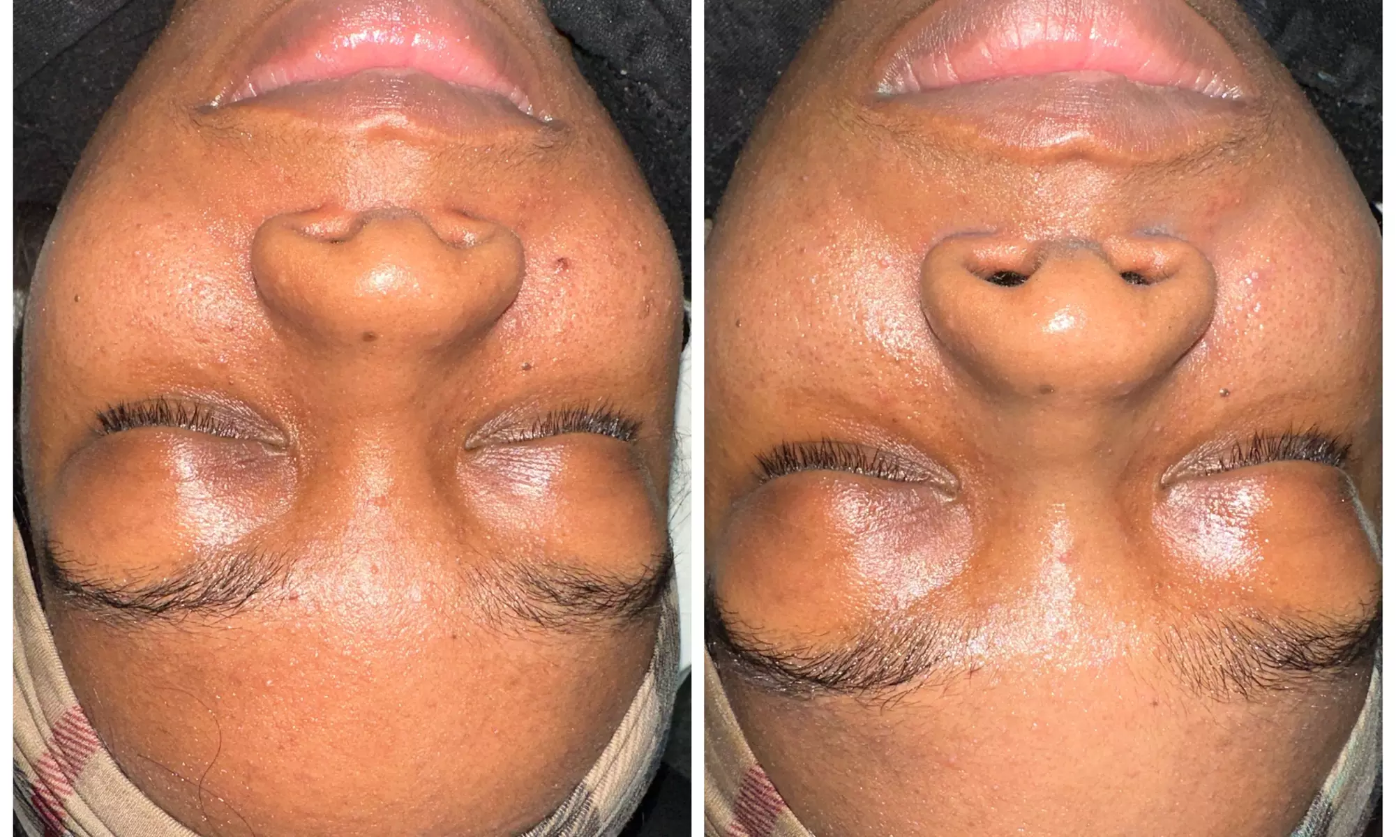 Up to 50% Off on 30 Minute Mini Facial at Honey B Esthetics - Primary Image