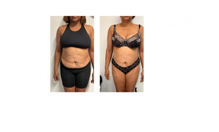 Image 10: Up to 58% Off on Fat Reduction - Non-Branded at Your Sculpt Studio