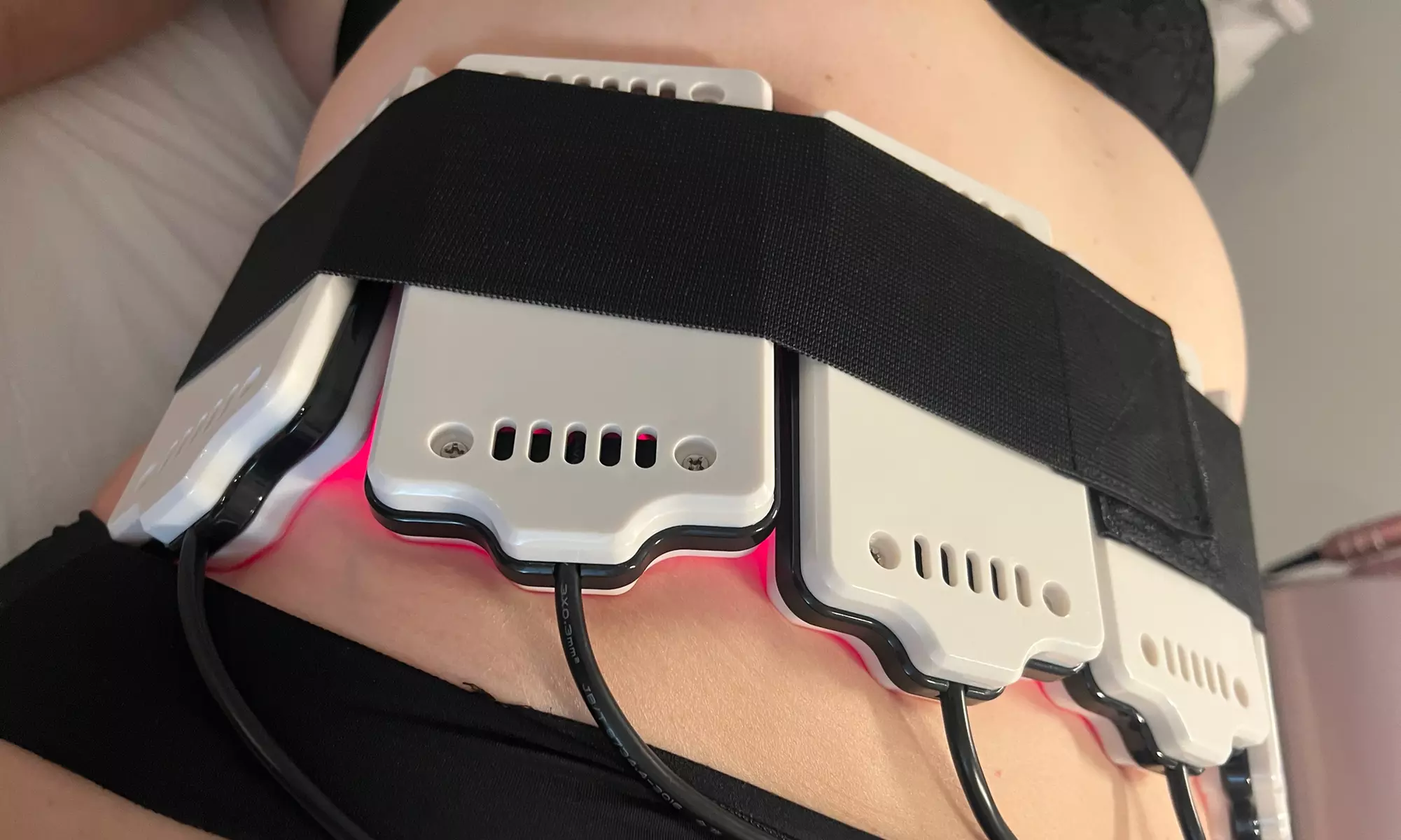 Lipo-Laser, Ultrasonic Fat Cavitation, RF Skin Tightening and Lymphatic Drainage at Forever YOU Dermal Clinic - Primary Image