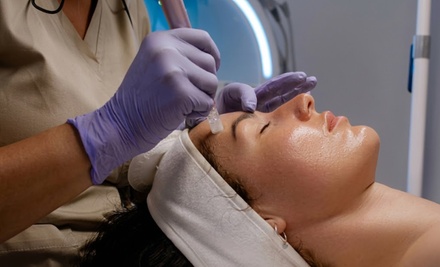 One Morpheus8 Session for Full Face and Neck - Beauty Perfections Med Spa