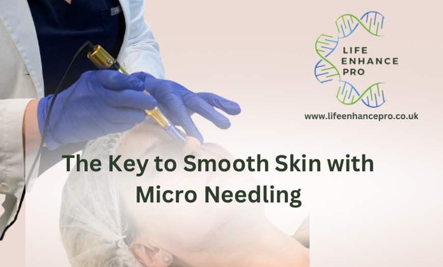 Image 3: Up to 52% Off on Micro-Needling at LifeEnhancePro