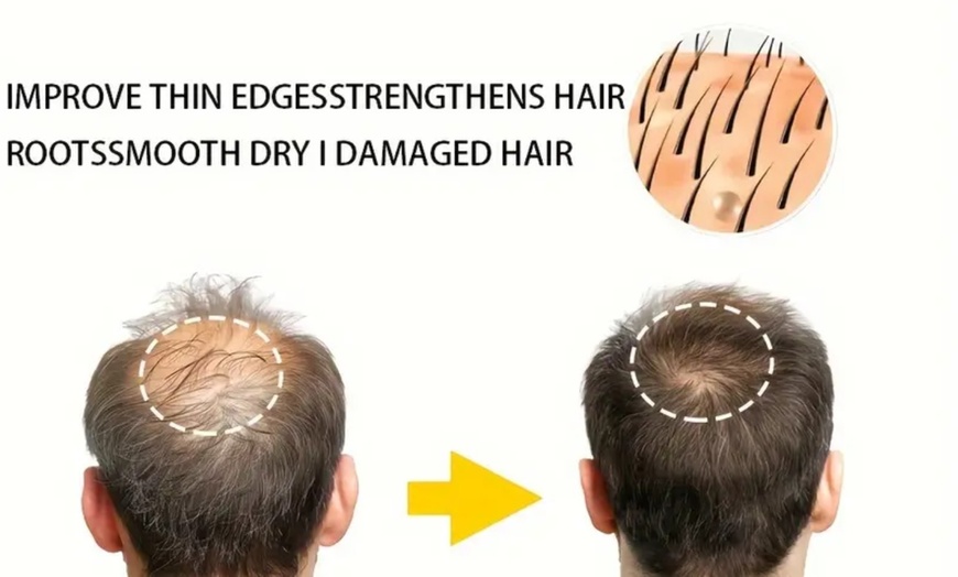 Image 1: Up to 67% Off Laser Hair Therapy Treatment for Regrowth