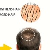Image 1: Up to 67% Off Laser Hair Therapy Treatment for Regrowth
