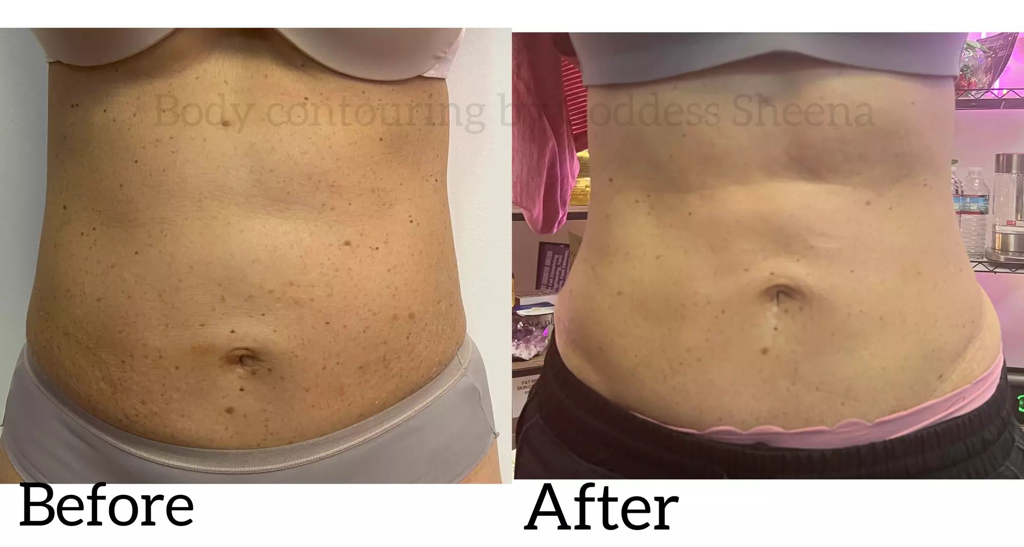 Body Contouring By Goddess Sheena offers Emsculpt 4 Sessions to shape your body up to 50% off - Second Medium