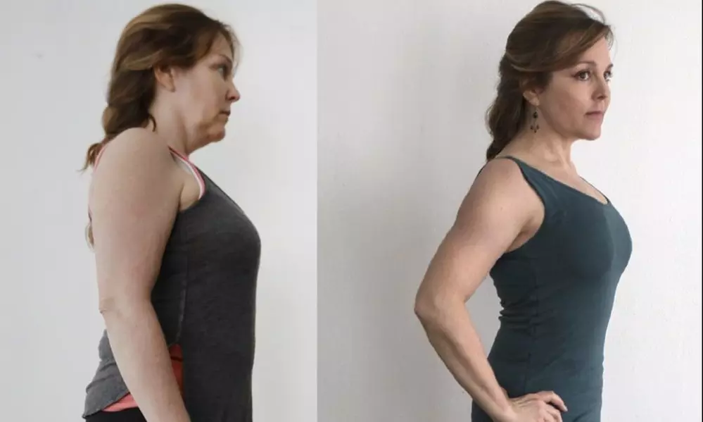 Boost Energy and Burn Fat with L-Cartinine and B-12 Injections