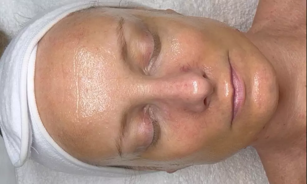 Up to 42% Off on Anti-Aging Facial at Revive Skin Studio - Primary Image