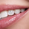 Image 1: Austrian Crystal Tooth Gems, Crystal Butterfly, Silver Bracelet & More